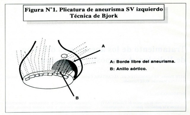 Figura 1. Tratamiento de los aneurismas del seno